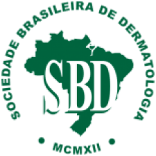 sbd